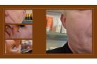 Martin's Anti Age Collagen Induction Therapy 300 min